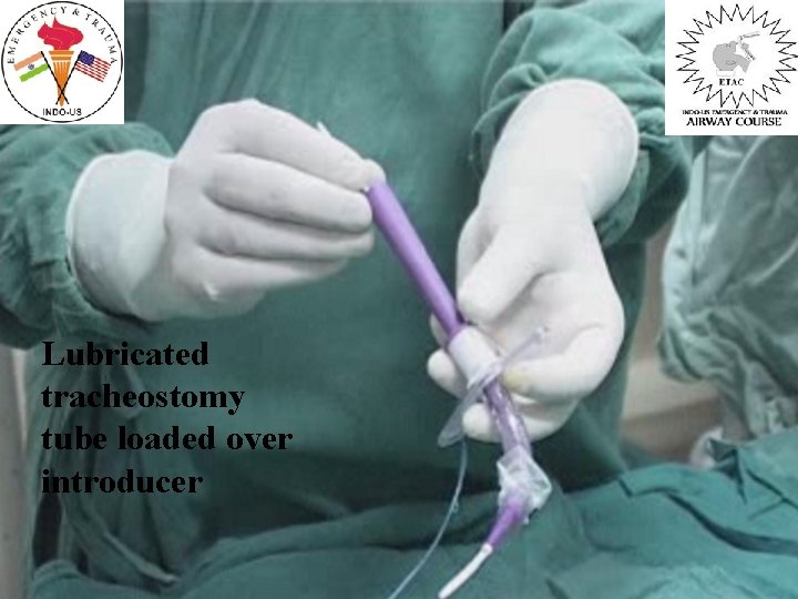 Lubricated tracheostomy tube loaded over introducer 