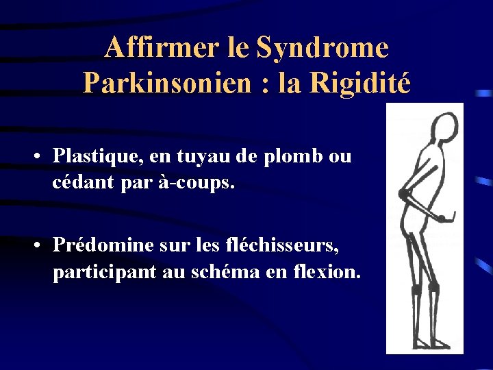 Affirmer le Syndrome Parkinsonien : la Rigidité • Plastique, en tuyau de plomb ou