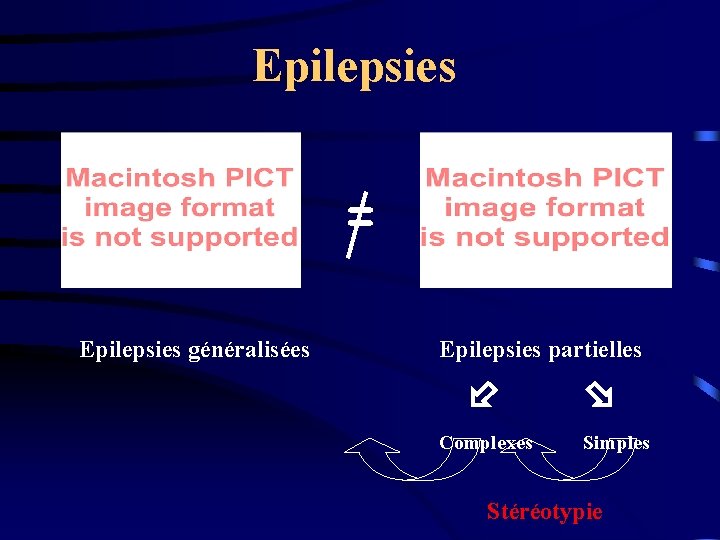 Epilepsies = Epilepsies généralisées Epilepsies partielles Complexes Simples Stéréotypie 