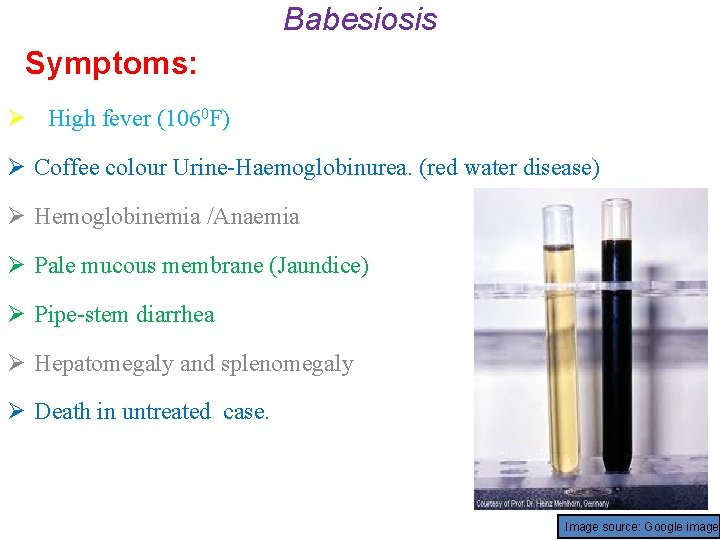 Babesiosis Symptoms: Ø High fever (1060 F) Ø Coffee colour Urine-Haemoglobinurea. (red water disease)