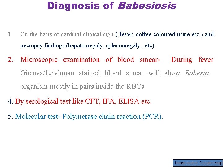 Diagnosis of Babesiosis 1. On the basis of cardinal clinical sign ( fever, coffee