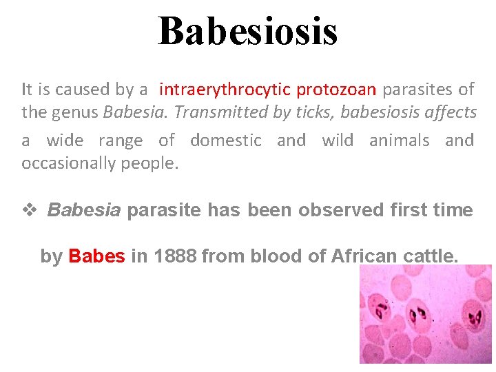 Babesiosis It is caused by a intraerythrocytic protozoan parasites of the genus Babesia. Transmitted
