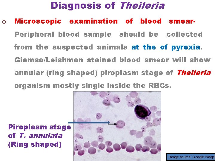 Diagnosis of Theileria o Microscopic examination Peripheral blood sample of blood should be smearcollected
