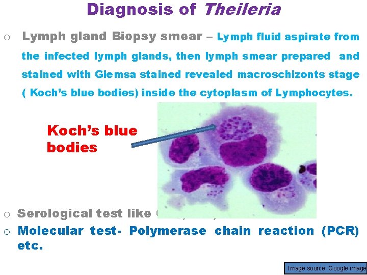 Diagnosis of Theileria o Lymph gland Biopsy smear – Lymph fluid aspirate from the