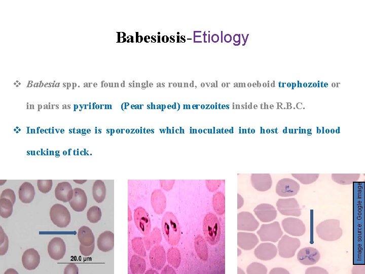 Babesiosis-Etiology v Babesia spp. are found single as round, oval or amoeboid trophozoite or