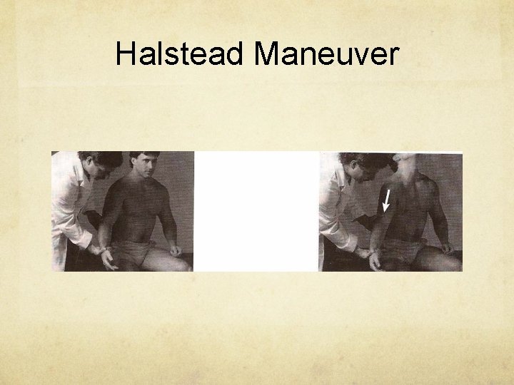 Halstead Maneuver 
