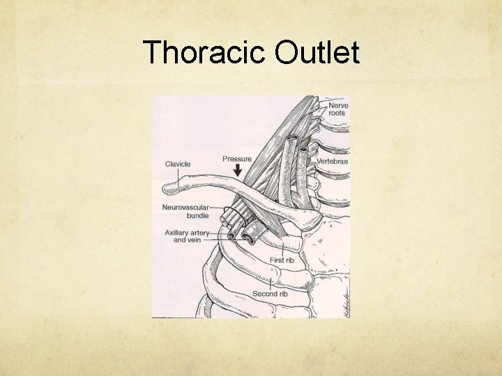 Thoracic Outlet 