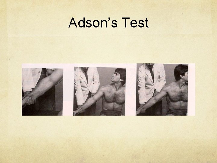 Adson’s Test 