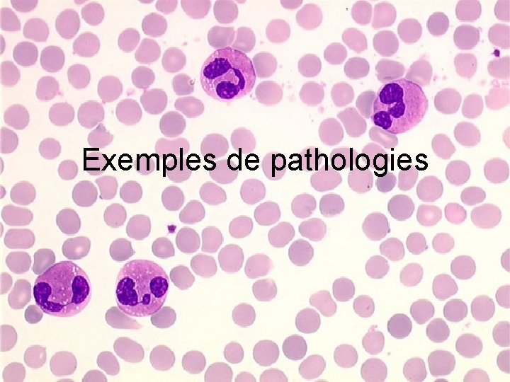 Exemples de pathologies 