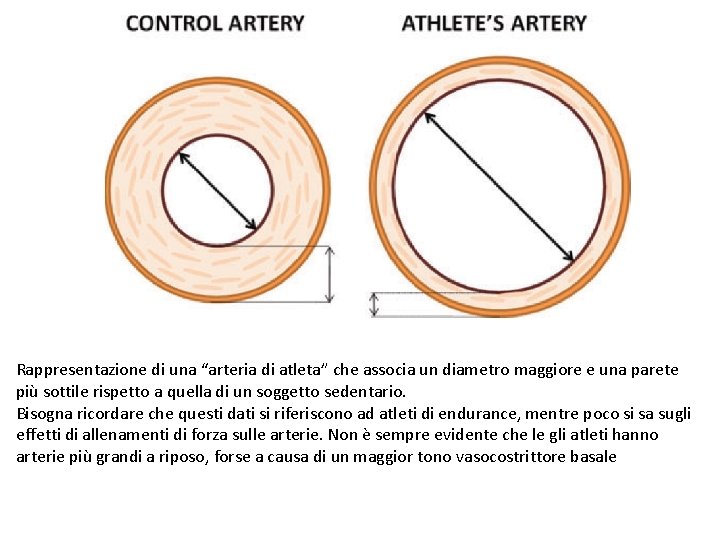 Rappresentazione di una “arteria di atleta” che associa un diametro maggiore e una parete