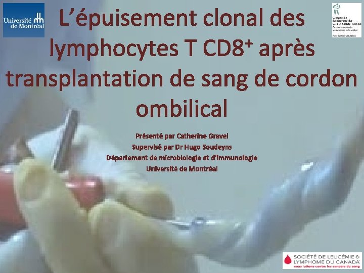 L’épuisement clonal des + lymphocytes T CD 8 après transplantation de sang de cordon