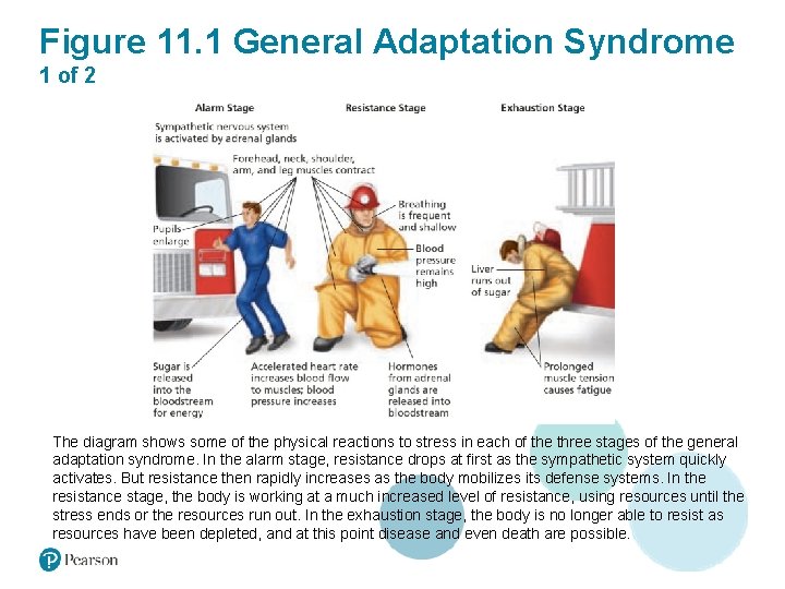 Figure 11. 1 General Adaptation Syndrome 1 of 2 The diagram shows some of