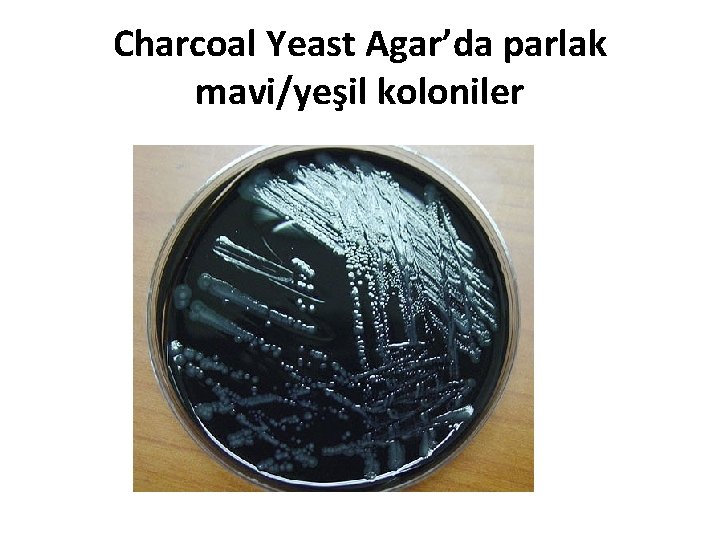 Charcoal Yeast Agar’da parlak mavi/yeşil koloniler 