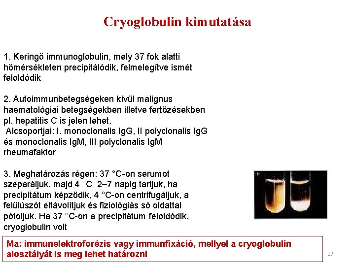 Cryoglobulin kimutatása 1. Keringö immunoglobulin, mely 37 fok alatti hömérsékleten precipitálódik, felmelegítve ismét feloldódik