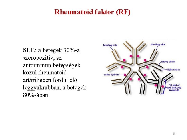 Rheumatoid faktor (RF) SLE: a betegek 30%-a szeropozitív, sz autoimmun betegségek közül rheumatoid arthritisben