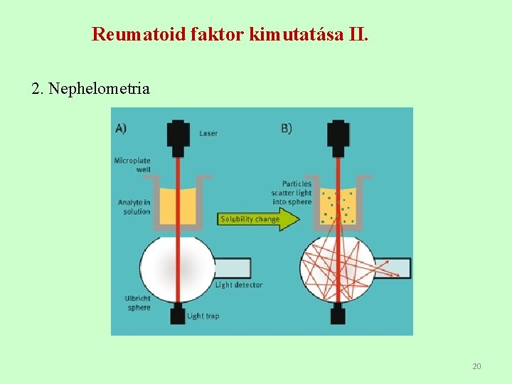 Reumatoid faktor kimutatása II. 2. Nephelometria 20 