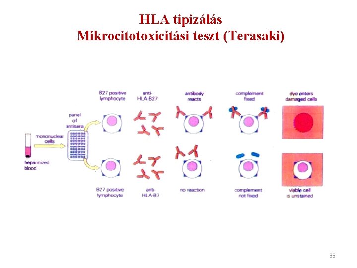 HLA tipizálás Mikrocitotoxicitási teszt (Terasaki) 35 