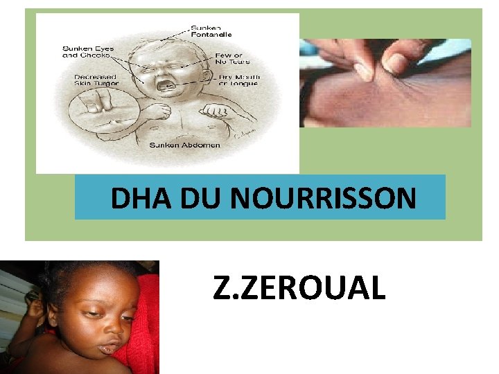 DHA DU NOURRISSON Z. ZEROUAL 