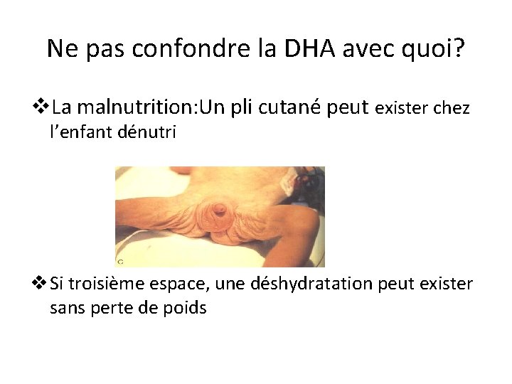 Ne pas confondre la DHA avec quoi? v. La malnutrition: Un pli cutané peut