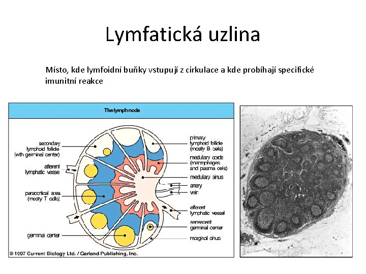 Lymfatická uzlina Místo, kde lymfoidní buňky vstupují z cirkulace a kde probíhají specifické imunitní