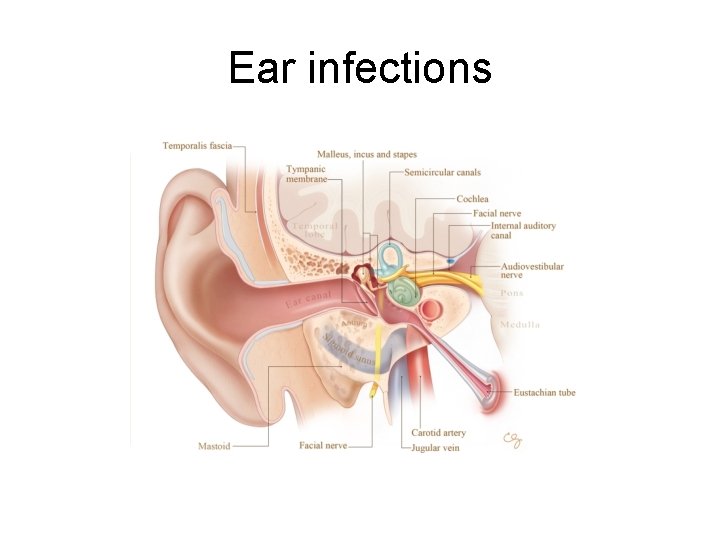 Ear infections 