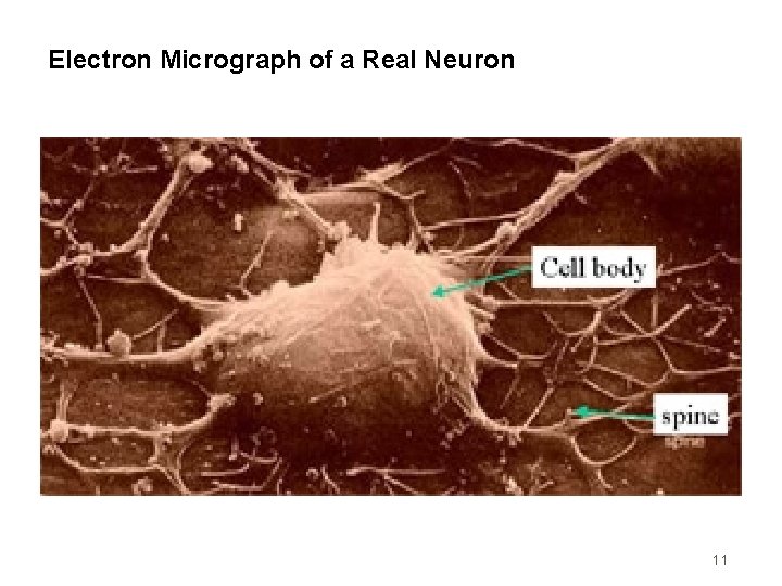 Electron Micrograph of a Real Neuron 11 