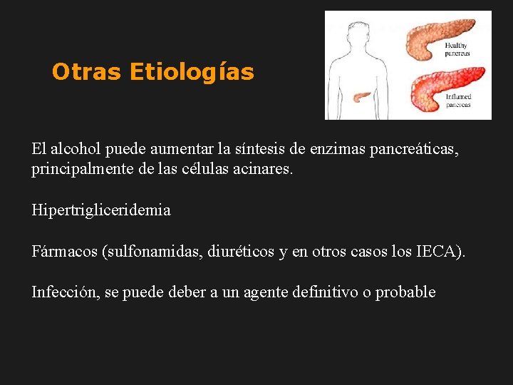 Otras Etiologías El alcohol puede aumentar la síntesis de enzimas pancreáticas, principalmente de las