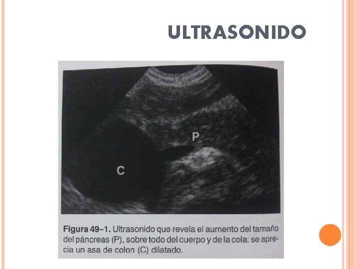 ULTRASONIDO 