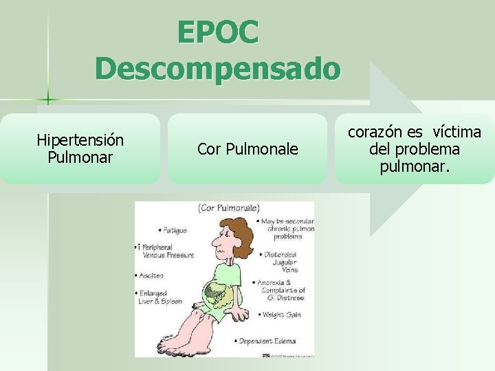 EPOC Descompensado Hipertensión Pulmonar Cor Pulmonale corazón es víctima del problema pulmonar. 