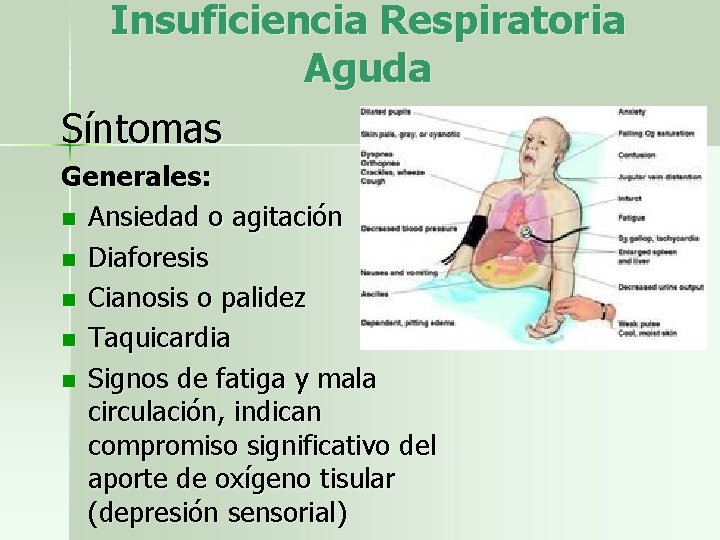 Insuficiencia Respiratoria Aguda Síntomas Generales: n Ansiedad o agitación n Diaforesis n Cianosis o