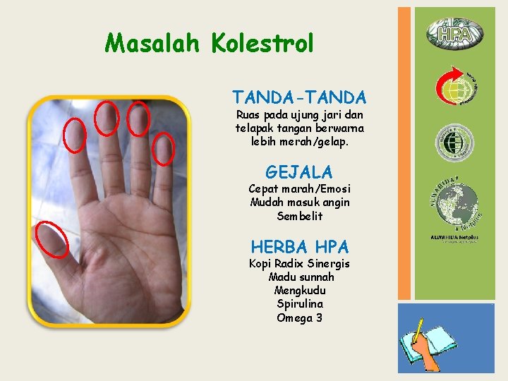 Masalah Kolestrol TANDA-TANDA Ruas pada ujung jari dan telapak tangan berwarna lebih merah/gelap. GEJALA