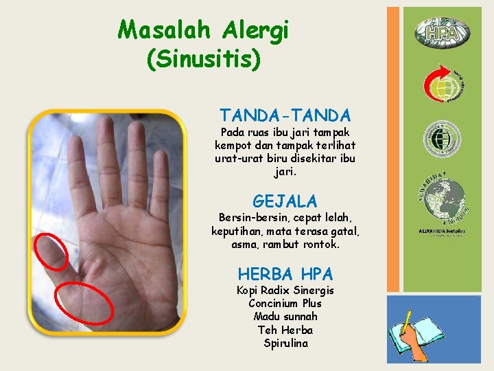 Masalah Alergi (Sinusitis) TANDA-TANDA Pada ruas ibu jari tampak kempot dan tampak terlihat urat-urat