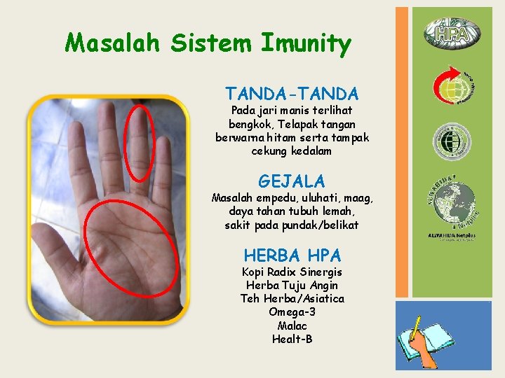 Masalah Sistem Imunity TANDA-TANDA Pada jari manis terlihat bengkok, Telapak tangan berwarna hitam serta