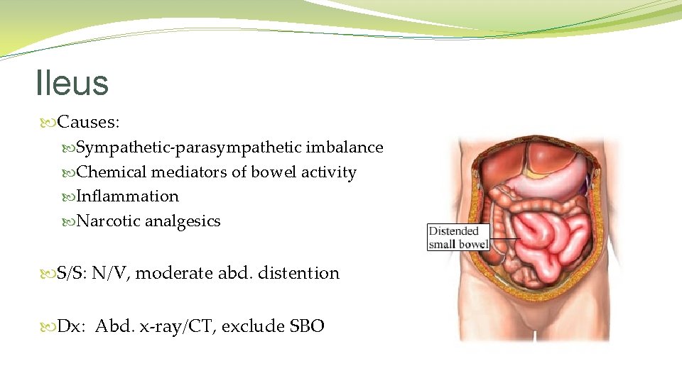 Ileus Causes: Sympathetic-parasympathetic imbalance Chemical mediators of bowel activity Inflammation Narcotic analgesics S/S: N/V,