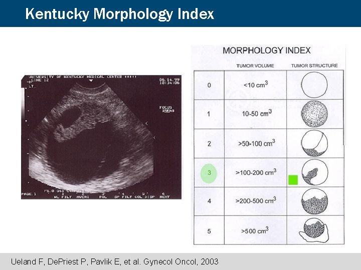 Kentucky Morphology Index Ueland F, De. Priest P, Pavlik E, et al. Gynecol Oncol, Kentucky Morphology Index Ueland F, De. Priest P, Pavlik E, et al. Gynecol Oncol,