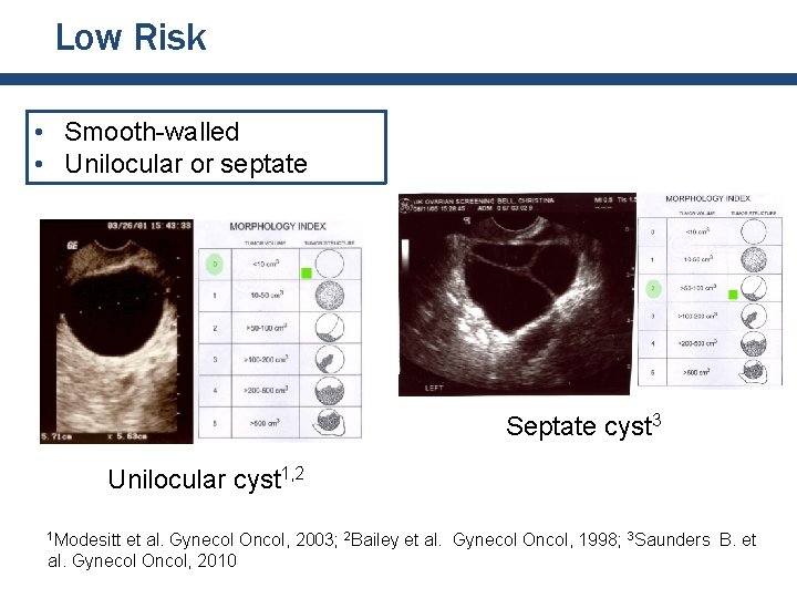Low Risk • Smooth-walled • Unilocular or septate Septate cyst 3 Unilocular cyst 1, Low Risk • Smooth-walled • Unilocular or septate Septate cyst 3 Unilocular cyst 1,