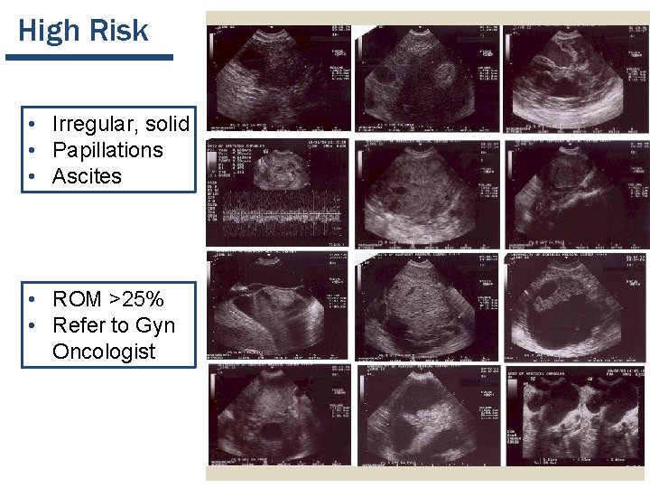 High Risk • Irregular, solid • Papillations • Ascites • ROM >25% • Refer High Risk • Irregular, solid • Papillations • Ascites • ROM >25% • Refer