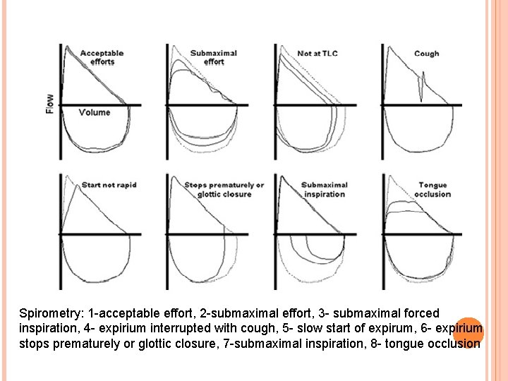 Spirometry: 1 -acceptable effort, 2 -submaximal effort, 3 - submaximal forced inspiration, 4 -