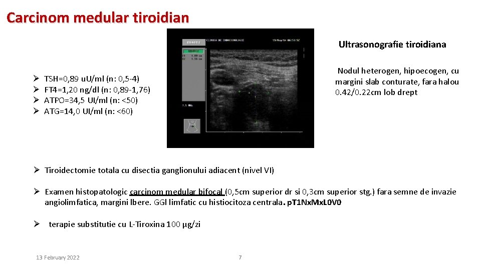 Carcinom medular tiroidian Ultrasonografie tiroidiana Ø Ø Nodul heterogen, hipoecogen, cu margini slab conturate,