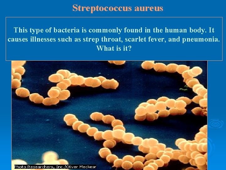 Streptococcus aureus This type of bacteria is commonly found in the human body. It Streptococcus aureus This type of bacteria is commonly found in the human body. It
