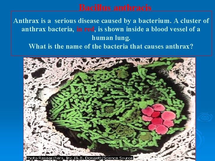 Bacillus anthracis Anthrax is a serious disease caused by a bacterium. A cluster of Bacillus anthracis Anthrax is a serious disease caused by a bacterium. A cluster of