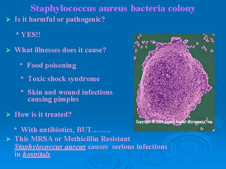 Staphylococcus aureus bacteria colony Ø Is it harmful or pathogenic? * YES!! Ø What Staphylococcus aureus bacteria colony Ø Is it harmful or pathogenic? * YES!! Ø What
