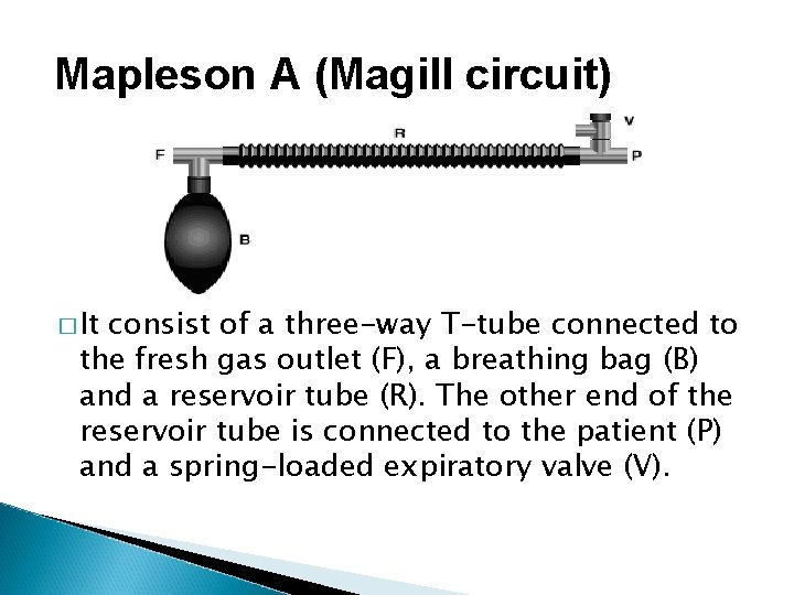 Mapleson A (Magill circuit) � It consist of a three-way T-tube connected to the