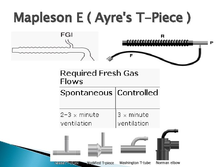 Mapleson E ( Ayre's T-Piece ) 