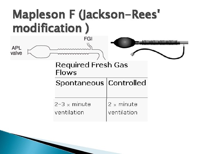 Mapleson F (Jackson-Rees' modification ) 