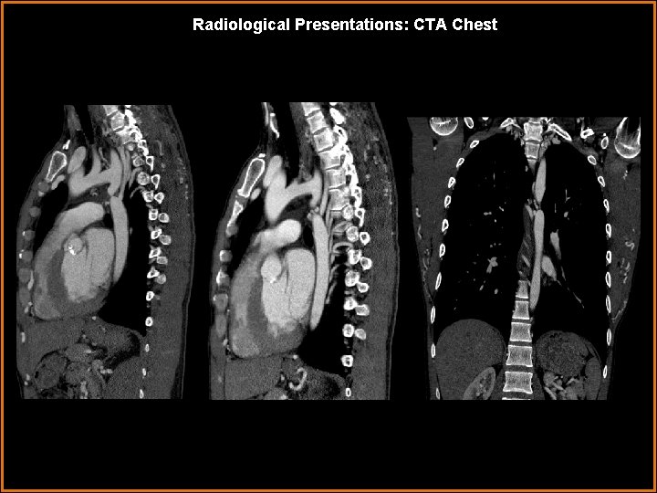 Radiological Presentations: CTA Chest 