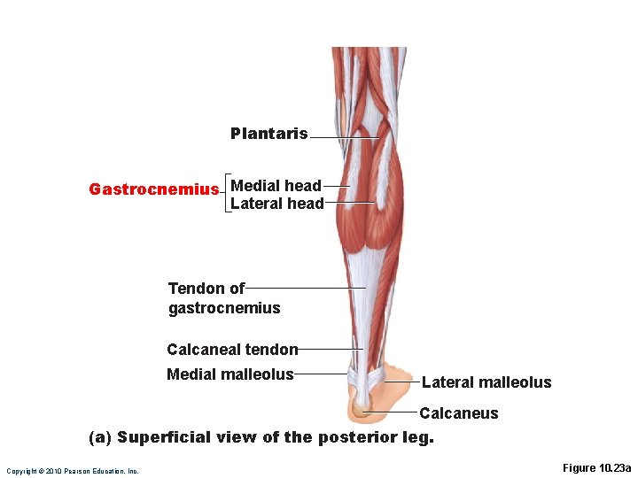 Plantaris Gastrocnemius Medial head Lateral head Tendon of gastrocnemius Calcaneal tendon Medial malleolus Lateral Plantaris Gastrocnemius Medial head Lateral head Tendon of gastrocnemius Calcaneal tendon Medial malleolus Lateral