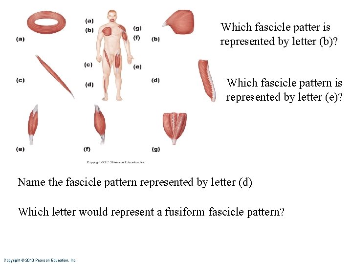 Which fascicle patter is represented by letter (b)? Which fascicle pattern is represented by Which fascicle patter is represented by letter (b)? Which fascicle pattern is represented by