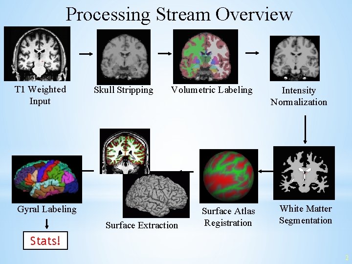 Processing Stream Overview T 1 Weighted Input Skull Stripping Volumetric Labeling Gyral Labeling Surface