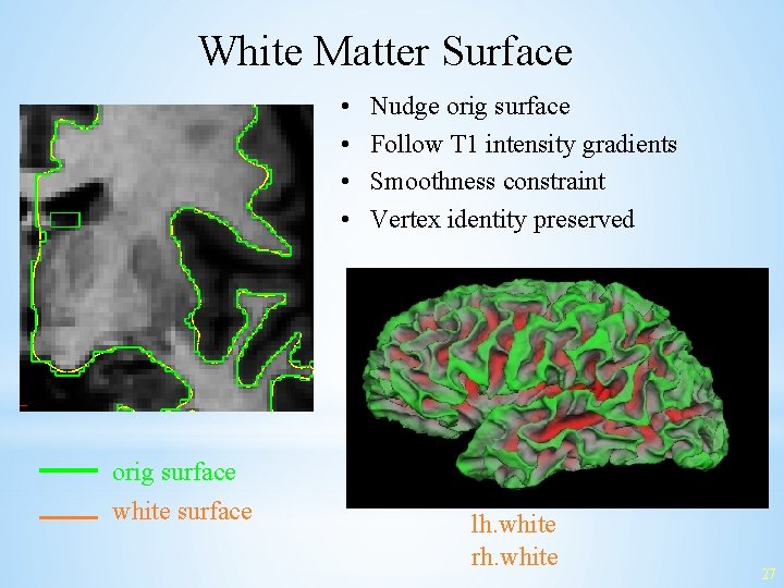 White Matter Surface • • orig surface white surface Nudge orig surface Follow T
